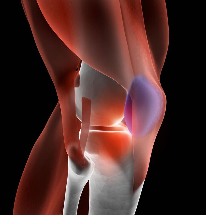 knee joint disease