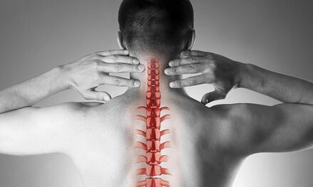 How does osteocartilage degeneration appear in the cervical vertebra