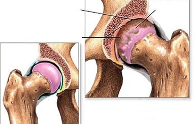 Hip joint diagnosis