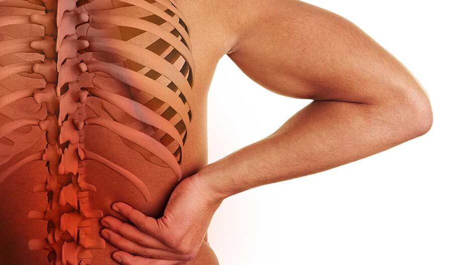 Lumbar osteochondrosis