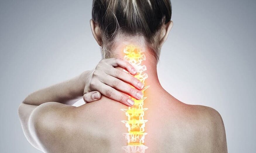 cervical osteochondrosis