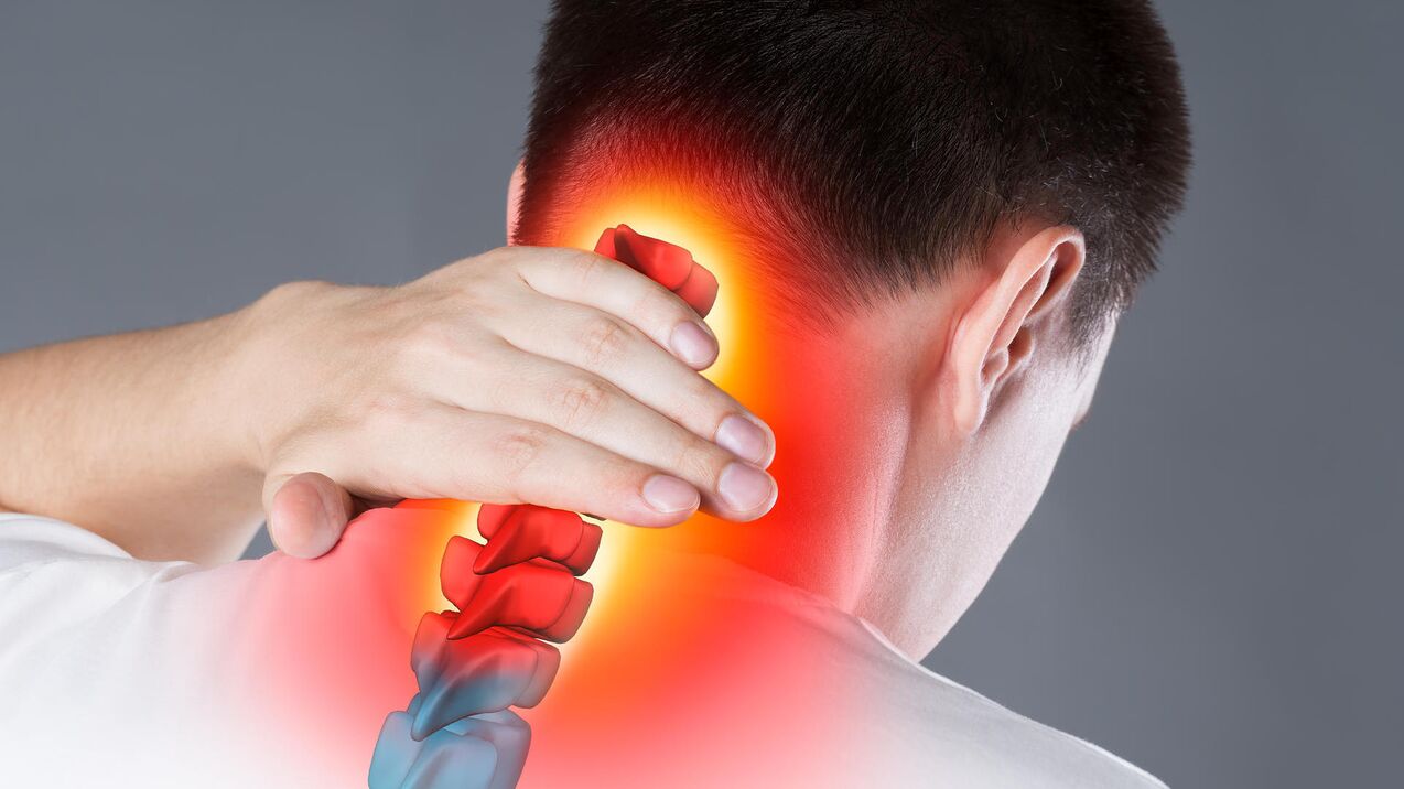 Neck pain due to osteochondrosis