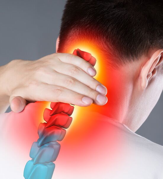 Neck pain in neck osteochondrosis